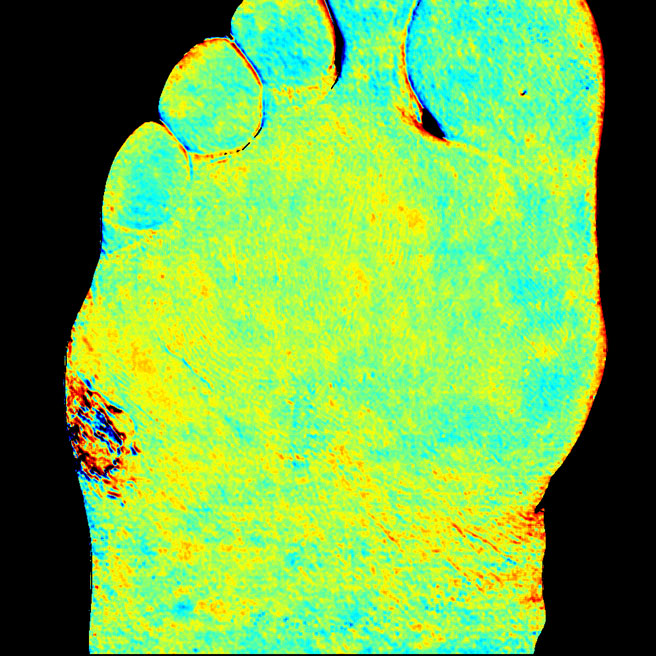 Foot O2satmap